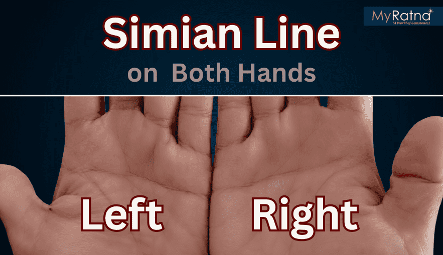 Simian Line on Both Hands