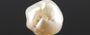Keshi Pearl - 10.02 Carat Rare Quality SSP-8690